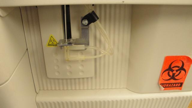 automated hematology analyzers